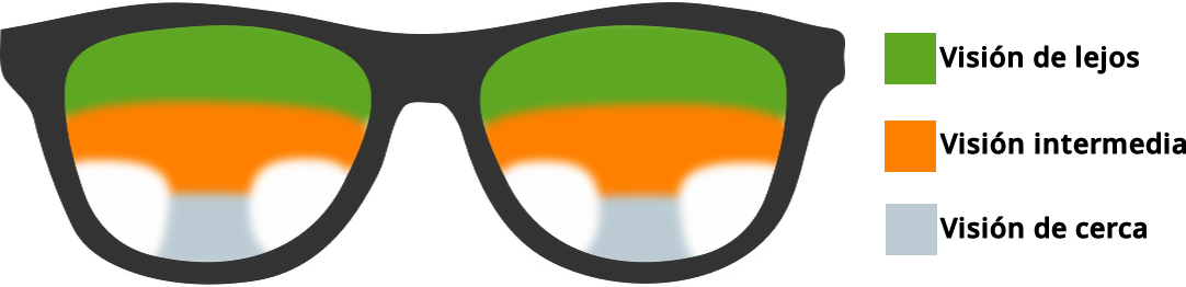 progresivo